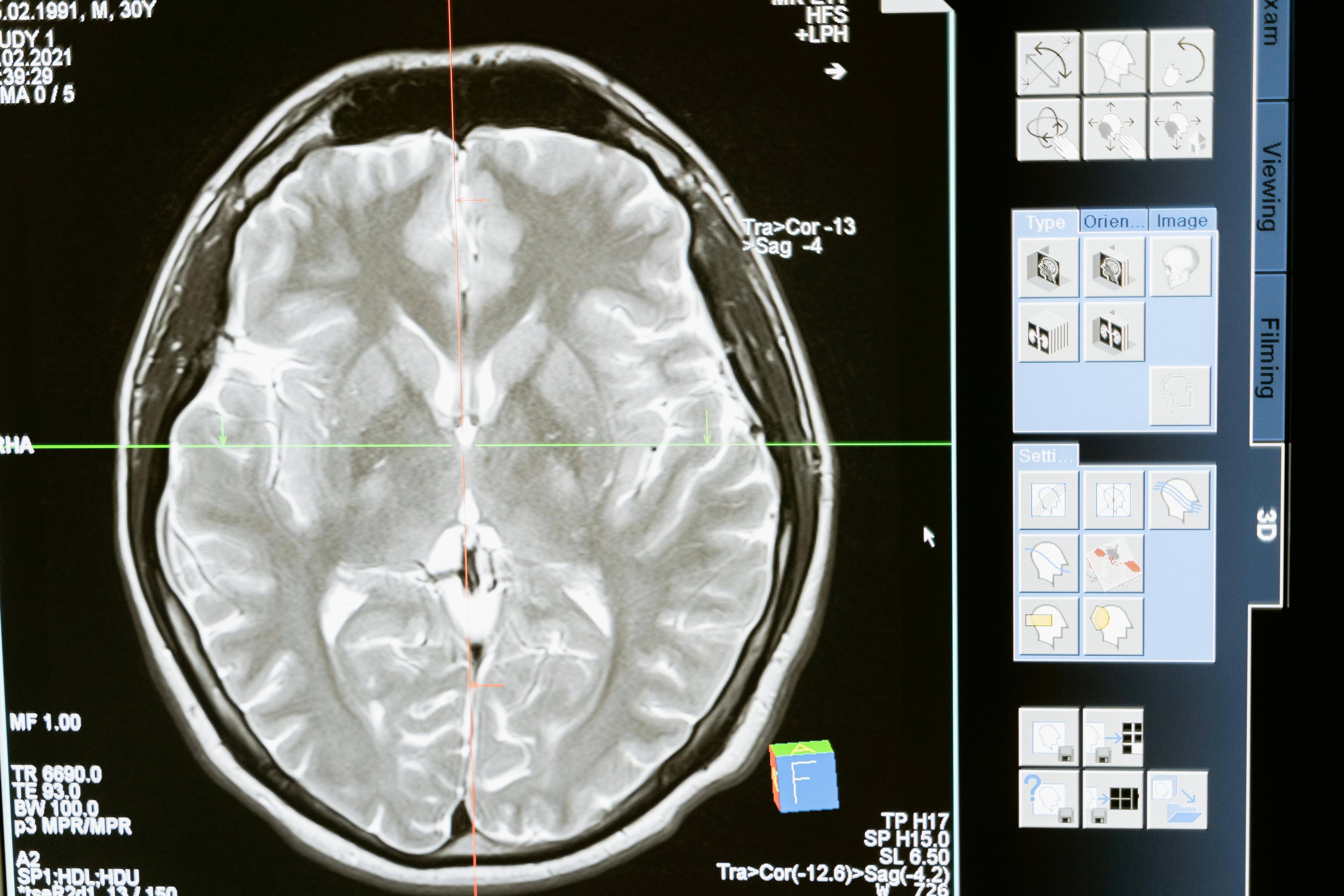 Radiological Procedures