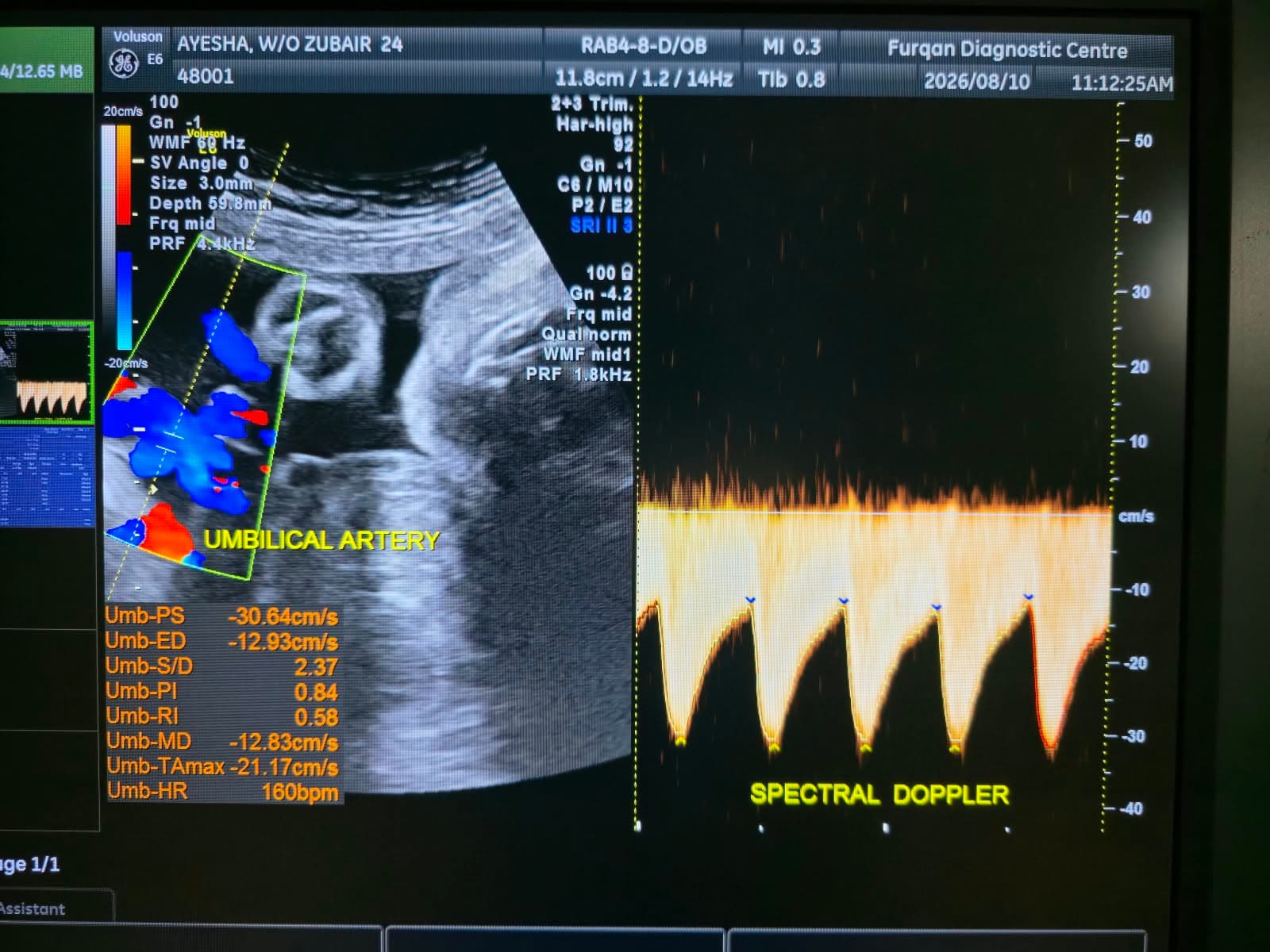 4D Obstetrics USG